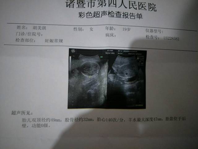 宝宝五个月了 保佑健健康康的足月出生_今天去