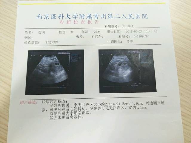 孕4月内·产检报告_B超日期:6.24~8.1~8.29 唐