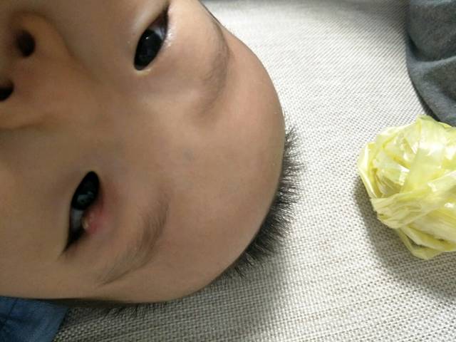 宝宝眼睛肿了怎么办_医生说是麦粒肿,拿的眼药