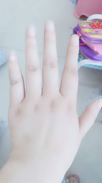 肿了_脚没肿,手肿了,体重一天一斤的节奏,好累