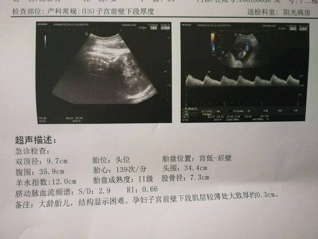 b超图像 图像主要参数