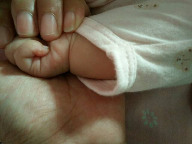 大家帮我看看_宝宝两个月多小拇指上起个水泡