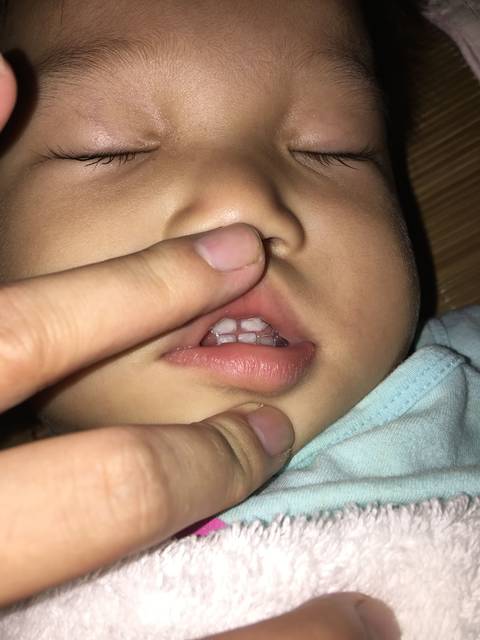 一岁两个月宝宝牙齿地包天怎么办_宝宝刚满一