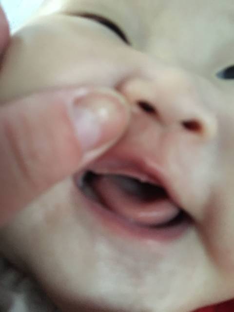 有经验的宝妈,来看看_这是牙吗?为什么牙龈上