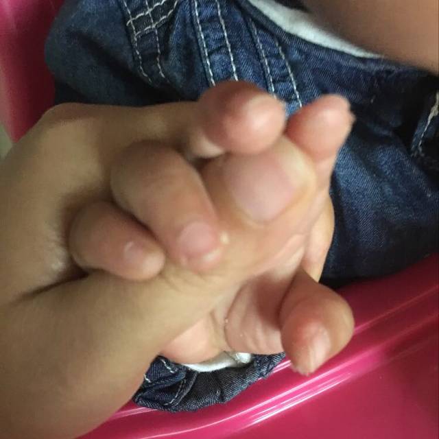 宝宝10个月了,手指脱皮是怎么回事啊?_宝宝1