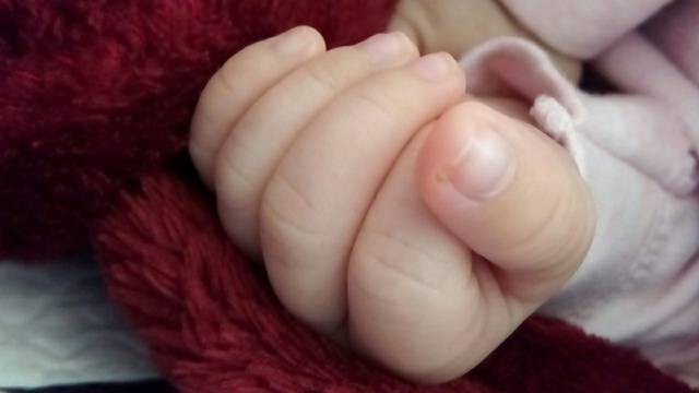 宝宝手指红肿是什么原因?_宝宝今天出生28天