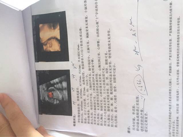 大家帮我看一下B超单_三维B超单能看得出男女