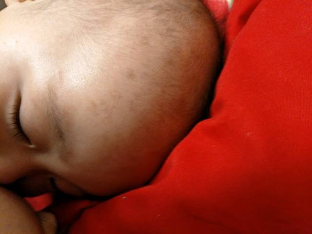 宝宝脸上的斑是什么_最近突然发现宝宝额头及