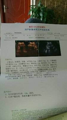 怀孕6个月,四维彩超显示宝宝右肾多囊性肾发育