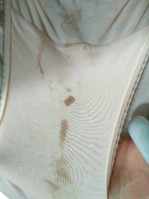 怀孕4周内裤上有竭色是什么原因