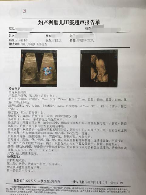 四维B超单,有会看男女的吗?_这是我的四维B超