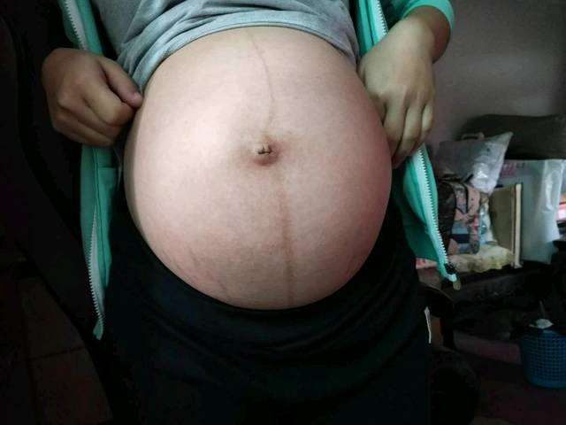 进来看肚子猜男女吧!_马上就37周了,这两天开始长的孕辰纹,_宝宝树