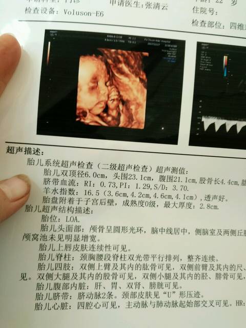 四维彩超归来,不知道男女,昨天照了没照到今天照了都健康