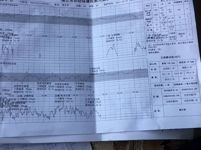 胎心监护20分钟有7次宫缩,1次胎动,什么时候能