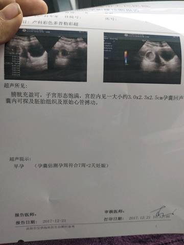 0*2.3*2.5孕囊是男孩还是女孩?头胎女宝,盼望来个男宝