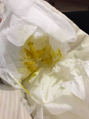宝宝刚满月,这样的大便正常嘛,有图慎入,有时候