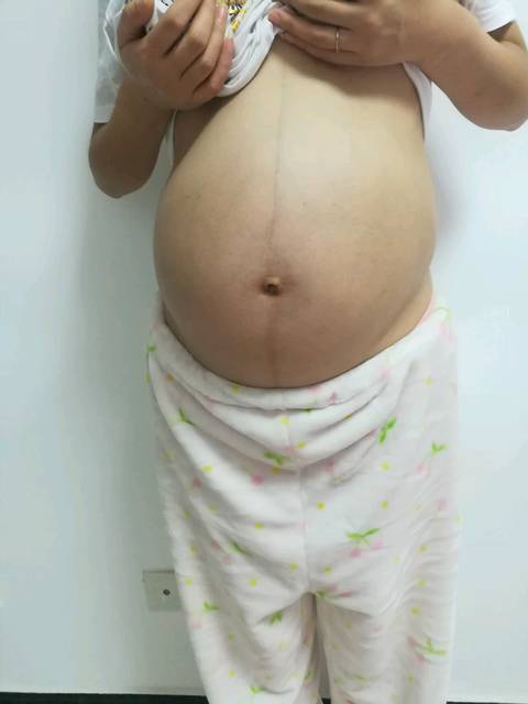 孕32周,右边动,肚脐眼也没有凸出来,看肚型猜男