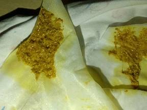 宝宝拉屎是这个颜色的,是消化不良引起的吗?母