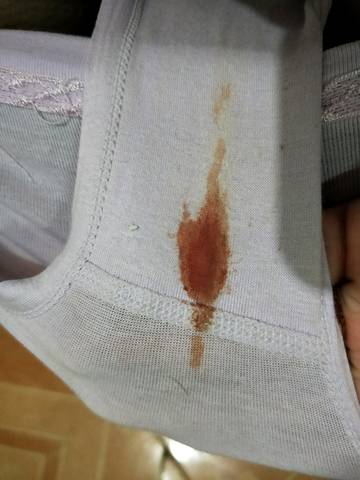 怀孕40天晚上见红,第二天变咖啡色血,然后就没