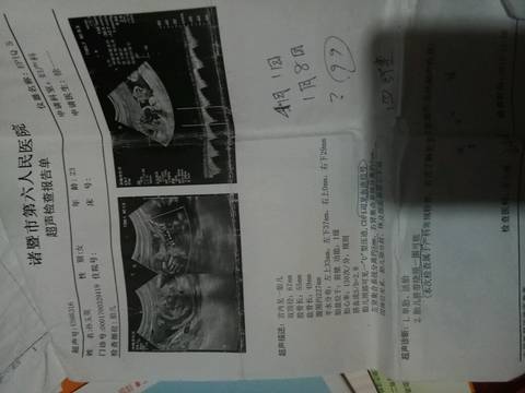 怎么看双顶径和股骨长分辨男女宝宝?有没有懂