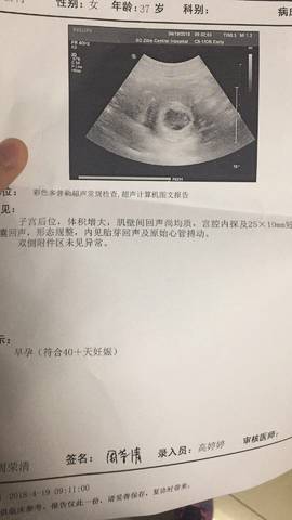 孕47天今天做的b超,已经有胎心胎芽了,能看出男女吗?好奇