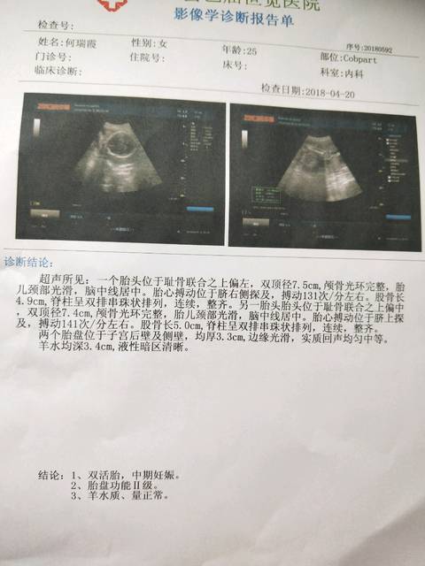 双胎孕28周,胎盘功能2级,大家帮我看看正常吗