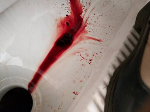 让人害怕今天的大姨妈都是这样的血块