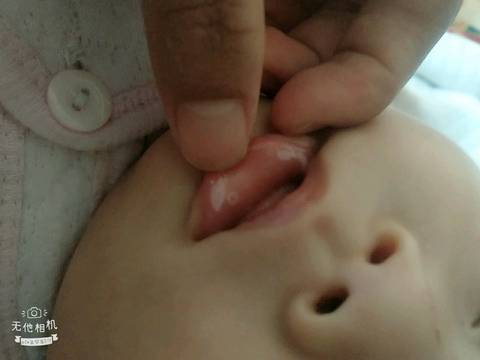 宝宝三个月嘴内两侧上侧嘴里都有白泡还好多擦