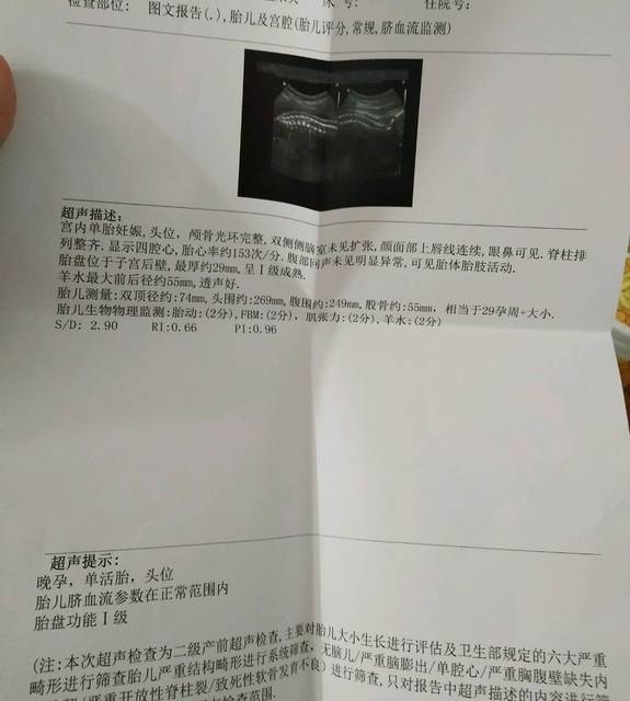 怀孕29周胎儿发育状况