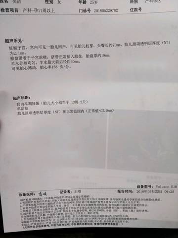 今天做的NT,各位宝妈能看我看看正常么,能看出