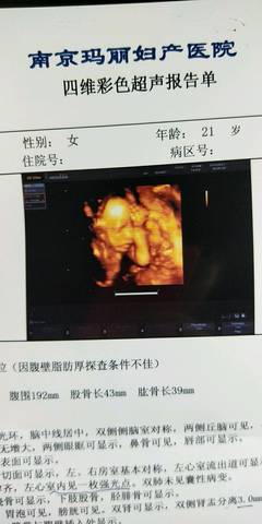 23周+5做的四维,医生说宝宝心脏有闪光点,可能