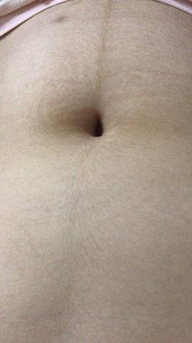 怀孕三个月肚子上长了很多毛是怎么回事?肚子