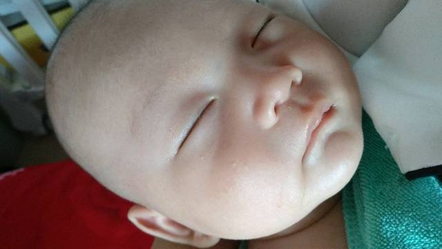 宝宝这是湿疹,还是胎毒,奶藓,或者别的?