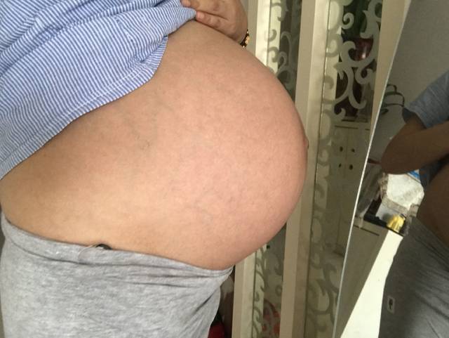 怀孕36周肚子相当大,好难受。好想早点生,走路