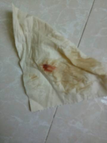 怀孕9周加,有一点点血丝,肚子没有任何不适,要