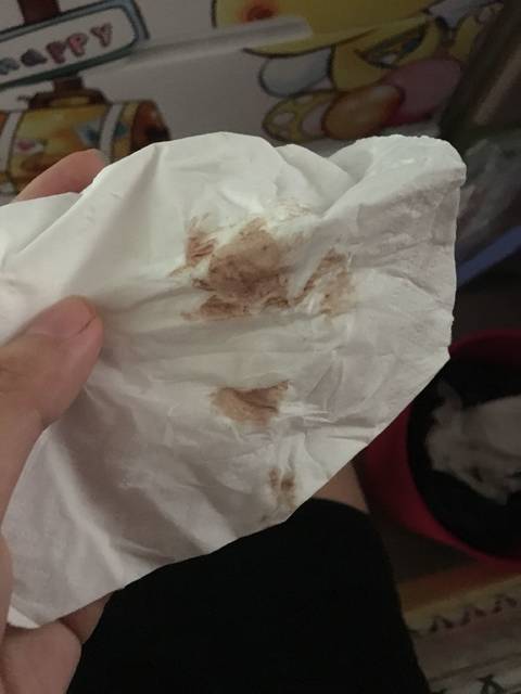 孕早期褐色分泌物怎么办