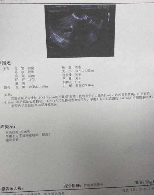 6周3昨天去验孕酮和hcg,今天出结果显示孕酮有