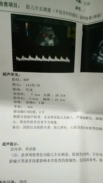 双顶径减股骨长判断男女