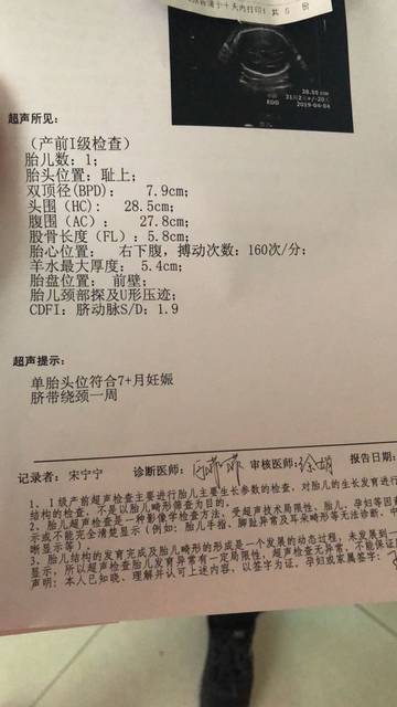 31周的单子    