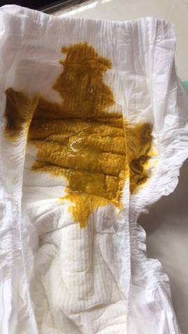 我宝宝五个月半拉肚子三四天了,怎么办