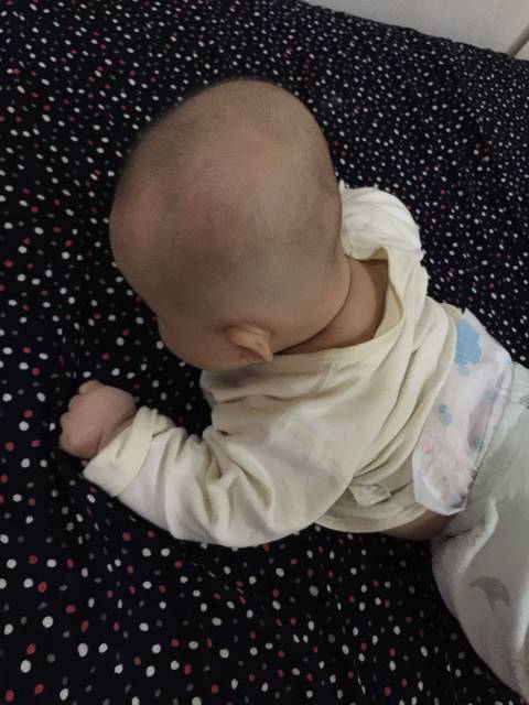 4个月的宝宝头睡扁了还能纠正吗?睡得后面很