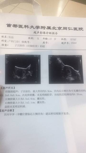 面对胚胎停育挑战：专家建议与应对措施