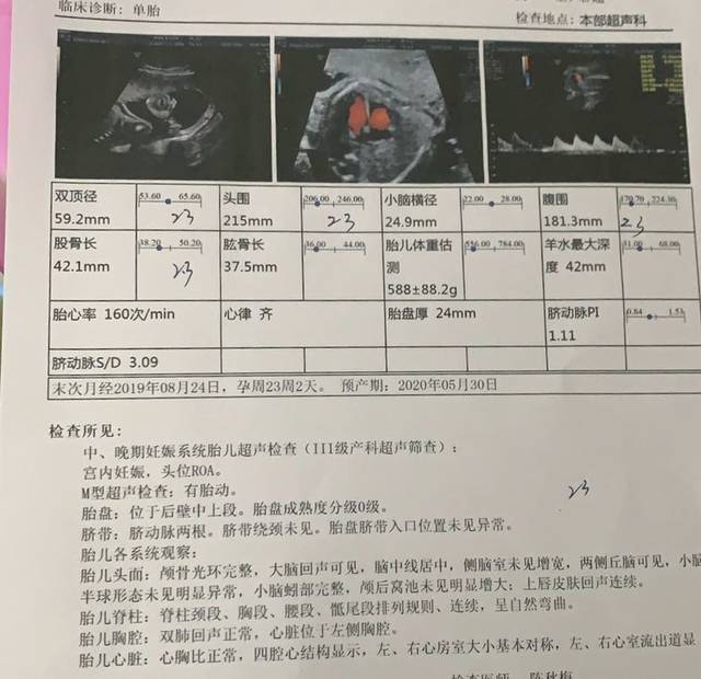 医学专家建议：面对三尖瓣轻微反流，采取积极监测与健康生活方式