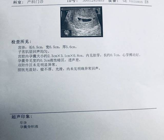 有人会看b超单子吗?