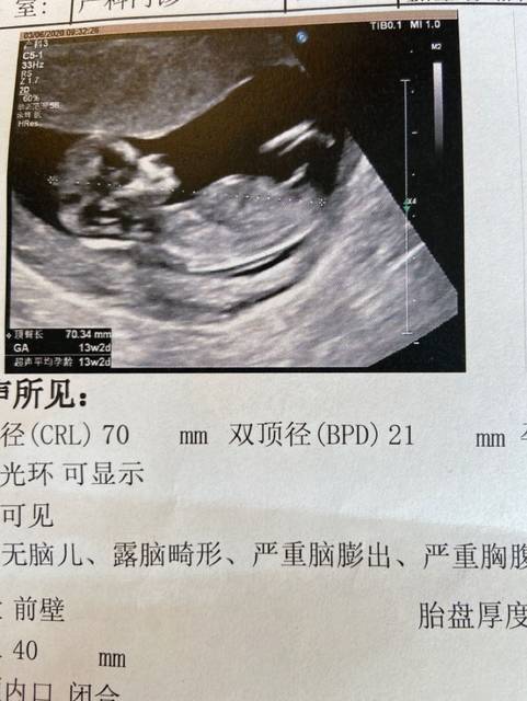 帮忙看看男女nt单子