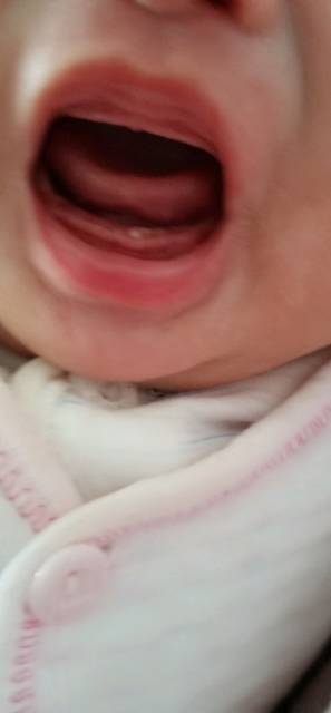 2个月能长牙_请问这是不是长牙的迹象,宝宝才2个月多!