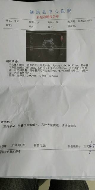 有孕早期宫腔积液的宝妈么._目前怀孕55天,知道怀孕就