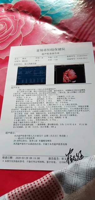 大家帮忙看一下四维彩超单男孩女孩