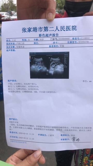 三个月双胞胎b超单