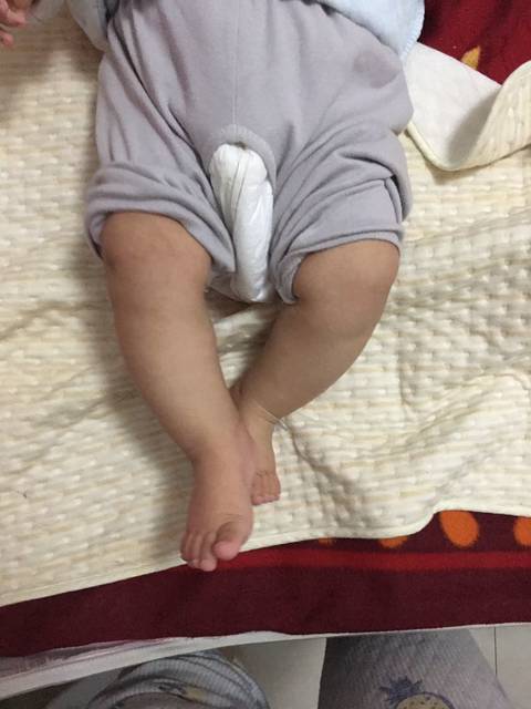 五个月的宝宝腿有点内扣,是o型腿么?